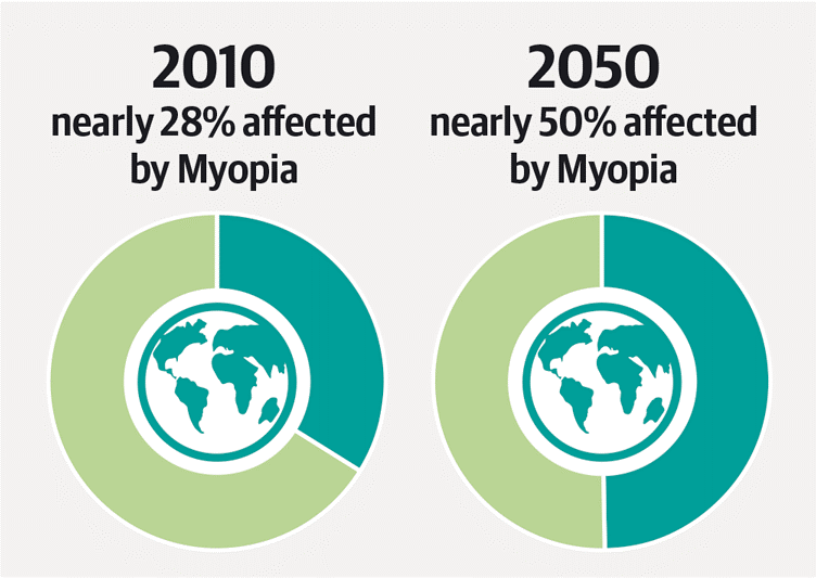 Ottica Esse4 statistiche miopia